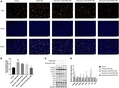 Myricanol Inhibits Platelet Derived Growth Factor-BB-Induced Vascular Smooth Muscle Cells Proliferation and Migration in vitro and Intimal Hyperplasia in vivo by Targeting the Platelet-Derived Growth Factor Receptor-β and NF-κB Signaling